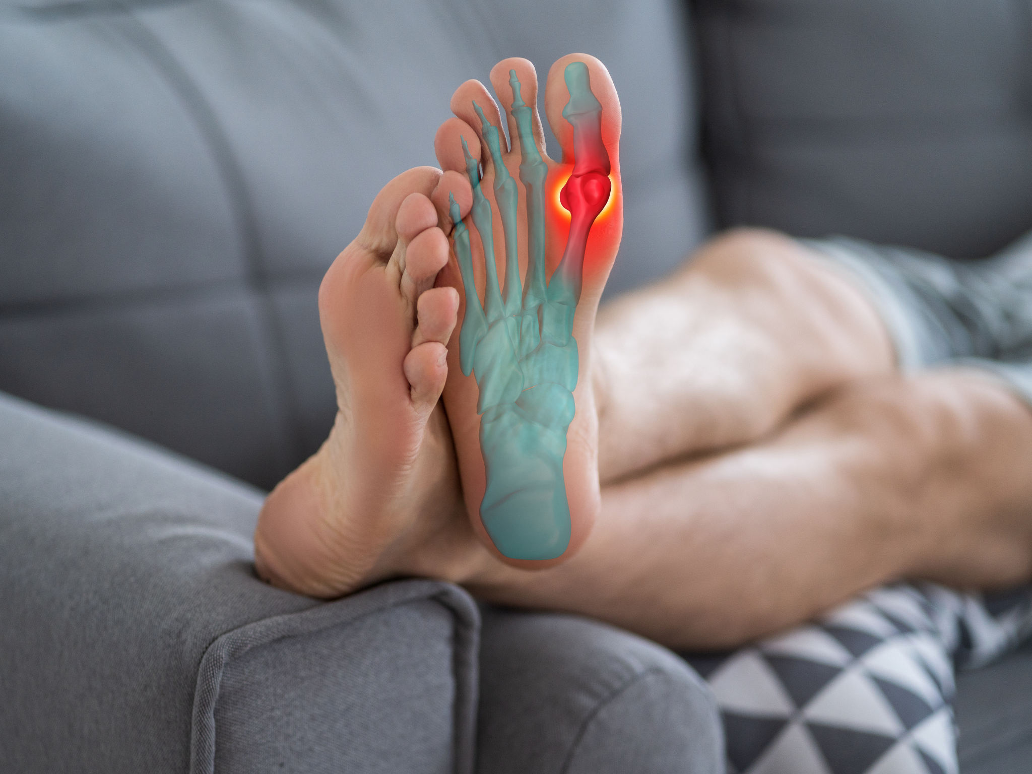 Steeds meer mensen krijgen jicht: dit zijn de eerste alarmsignalen