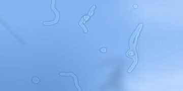 Zie jij ook ‘floaters’ in je ogen? Dít is wat er écht aan de hand is…